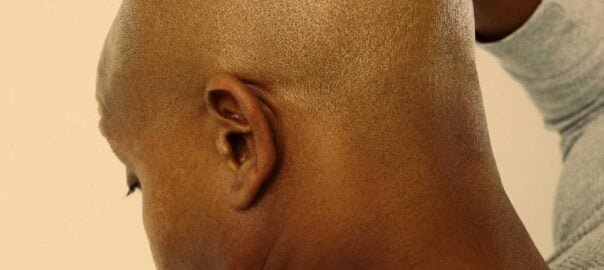 6 Best Bald Head Moisturizers For Happy Crowns in 2026 | FashionBeans 6 Best Bald Head Moisturizers For Happy Crowns in 2026 | FashionBeans